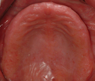 Restores appearance and function 2