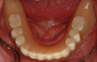 Restores appearance and function 5