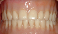 Restores appearance and function 6