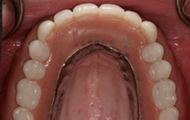 Restores smile and function 4
