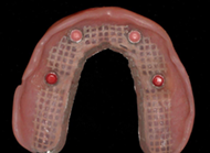 Restores smile and function 5